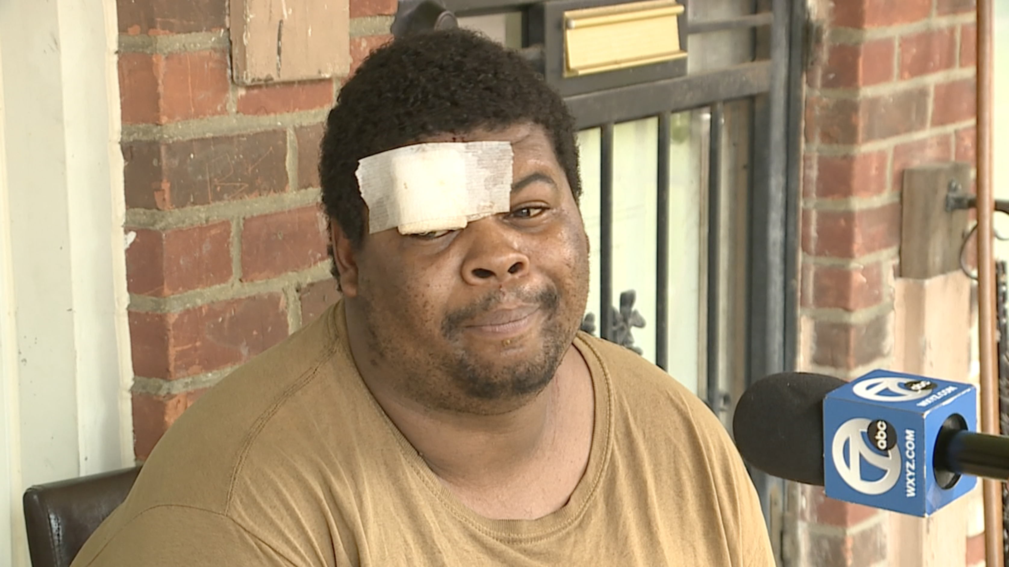 Driver hits person and porch in Detroit neighborhood, isn't arrested - Vimarsana News