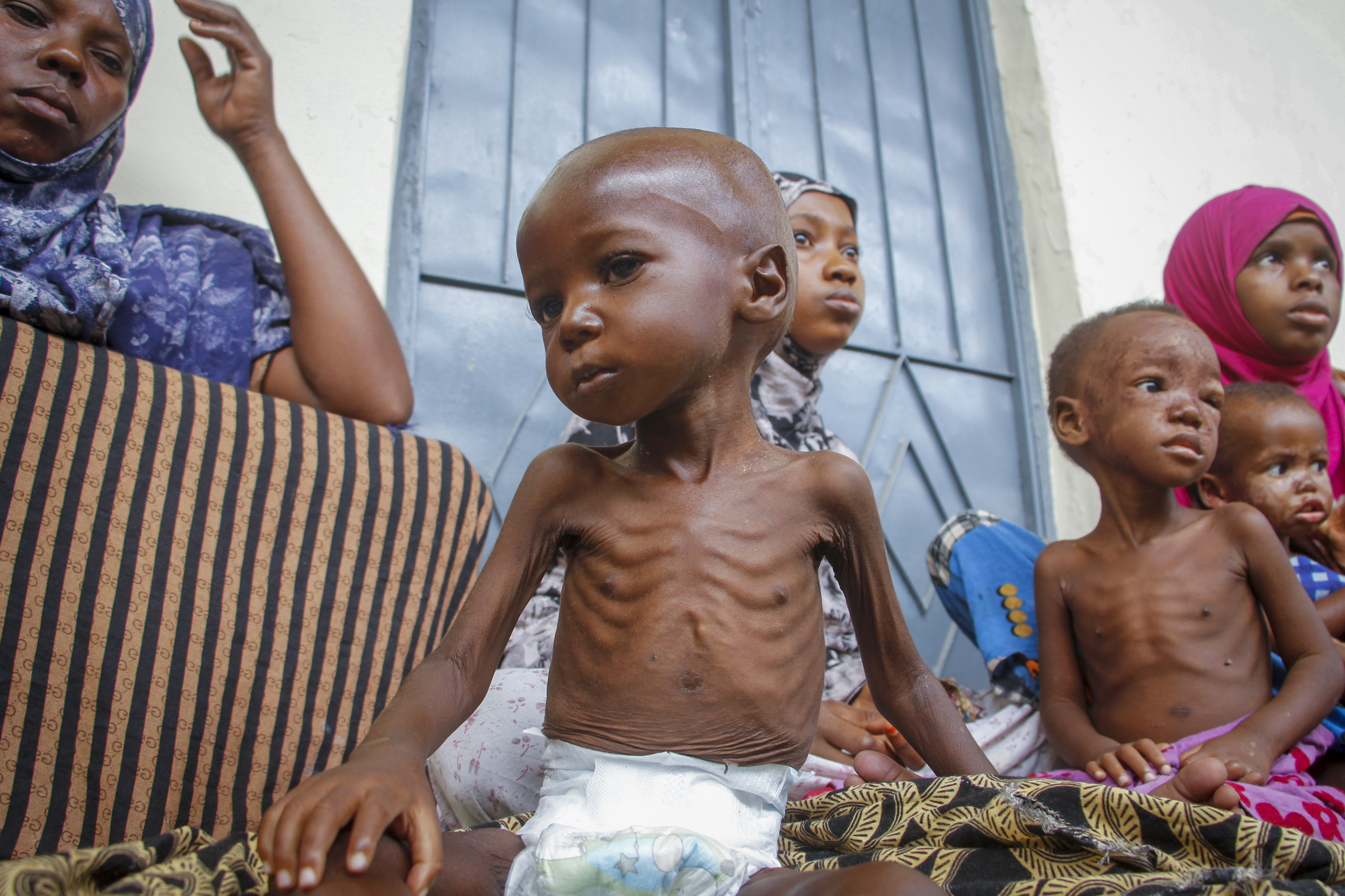 'Only God can help': Hundreds die as Somalia faces famine - Vimarsana News