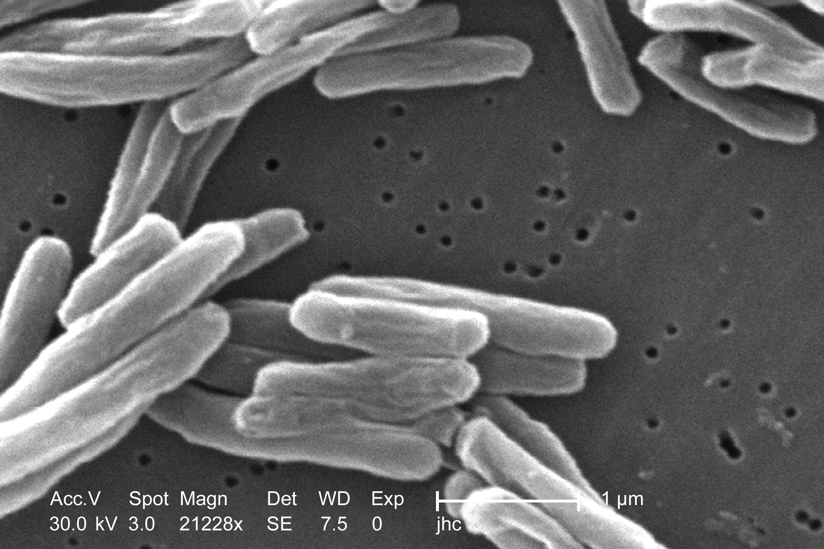 The path to a better tuberculosis vaccine runs through Montana - Vimarsana News
