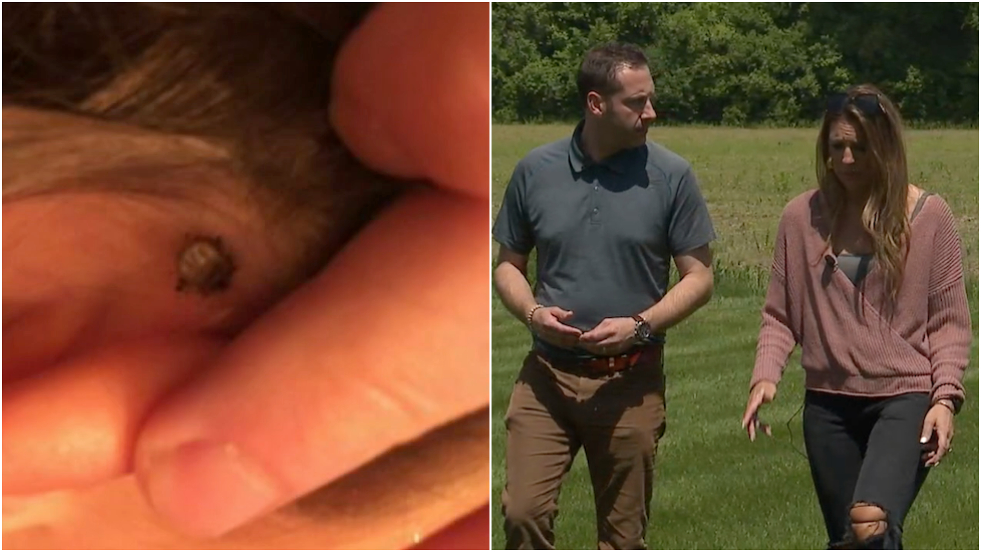 'Burning, some pain': Tick cases rise due to mild winter - Vimarsana News