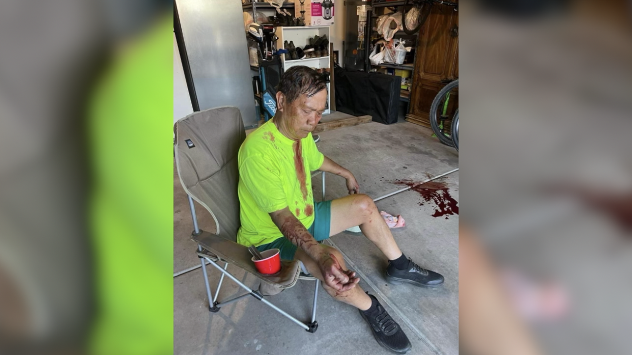 Protest planned following beating of elderly Filipino man in Las Vegas - Vimarsana News